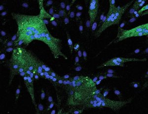 Working a genetic slay signal accelerates oxygen metabolism and vitality production in horses | Science