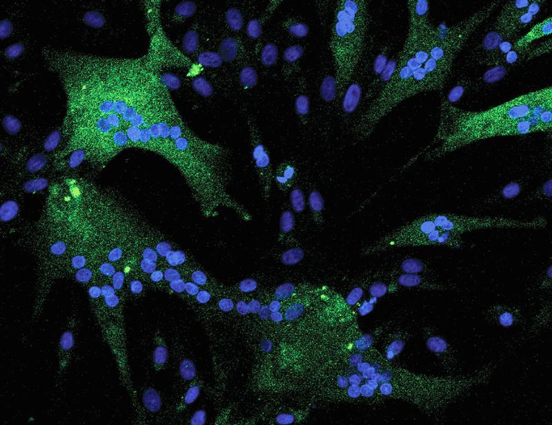 Working a genetic slay signal accelerates oxygen metabolism and vitality production in horses | Science