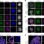 Beforehand unknown SCEP3 protein found basic for plant chromosome mixing in meiosis