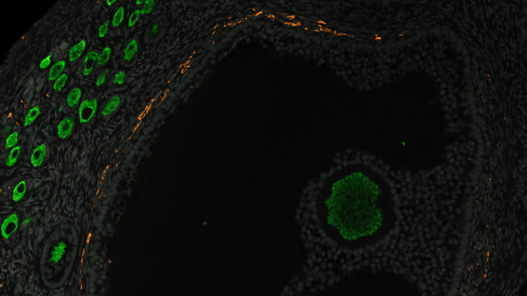 We sooner or later have a thought of how the lifetime provide of eggs develops in primates