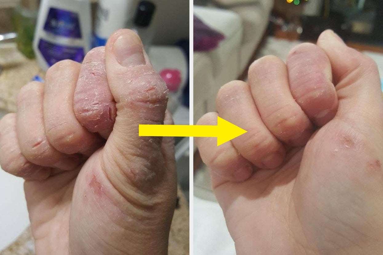 32 Hydrating Merchandise To Originate The expend of *Before* Your Skin Feels Scaly And Your Lips Win Chapped