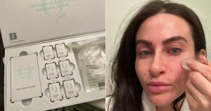 I Tried the TikTok-Viral Microneedling Device
